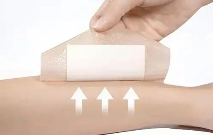 Zhuopu Medical participa com sucesso em exposi&ccedil;&otilde;es internacionais de tratamento de feridas em 2026 &ndash; Fortalecendo parcerias globais para curativos para feridas OEM